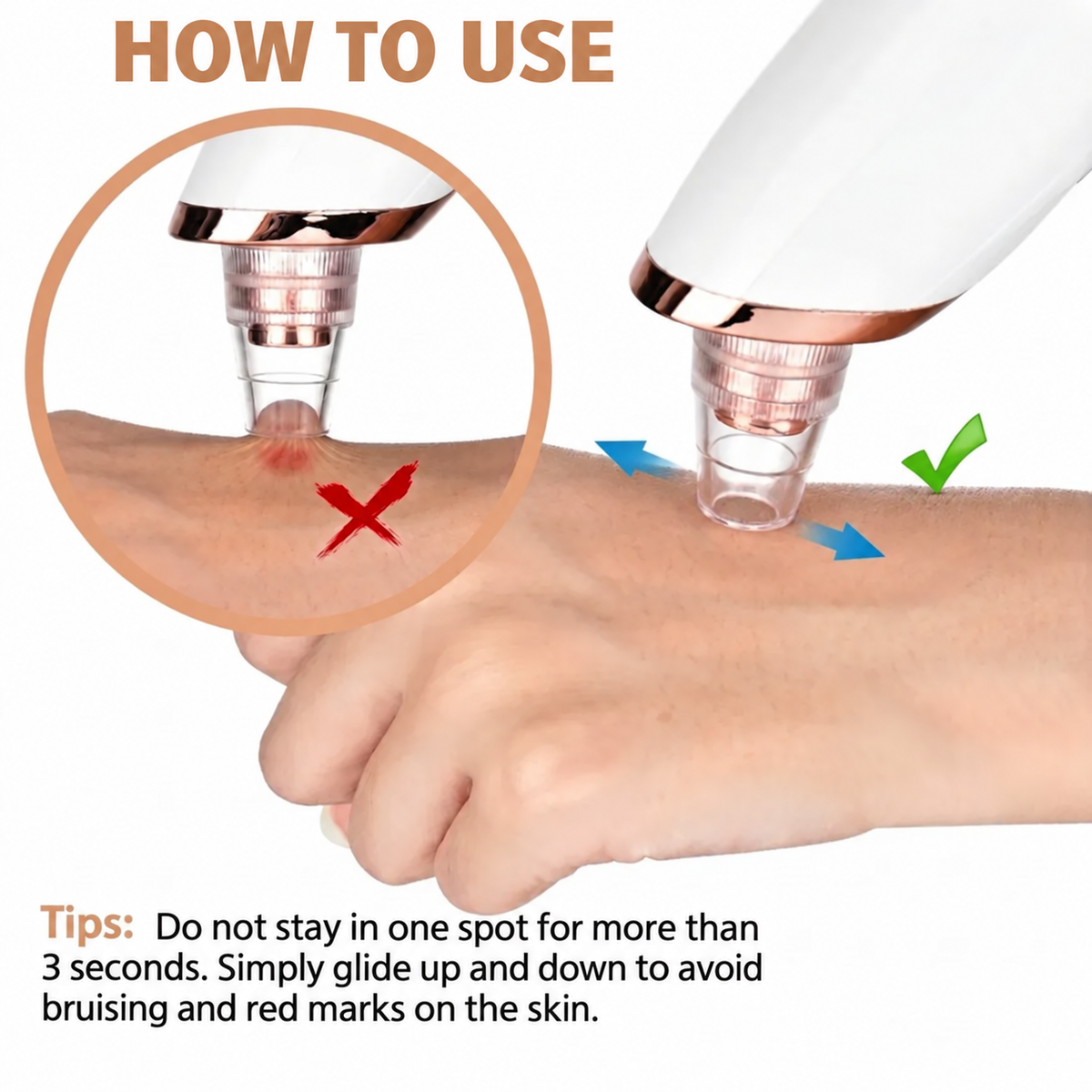 đ„ SAVE 50% - Electric Blackhead Remover